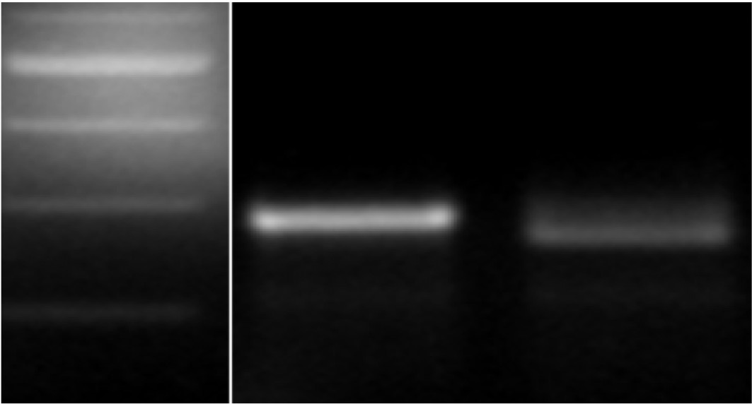 300 bp and 200 bp, M 2174 and Jagger marker for genotyping. 300 bp and 200 bp, M 2174 and Jagger marker for genotyping.